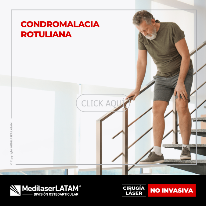 Condromalacia rotuliana: tratamiento láser para aliviar dolor y desgaste de cartílago. 90% efectividad. Sin cirugías, sin dolor.