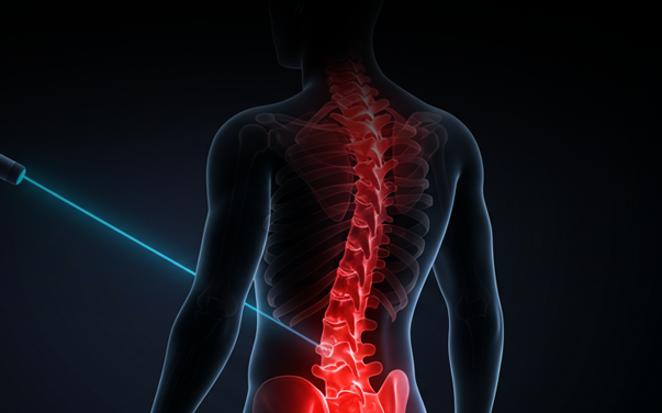 Terapias con láser para regeneración articular y discal. Procedimientos seguros, sin dolor y con altos índices de éxito.