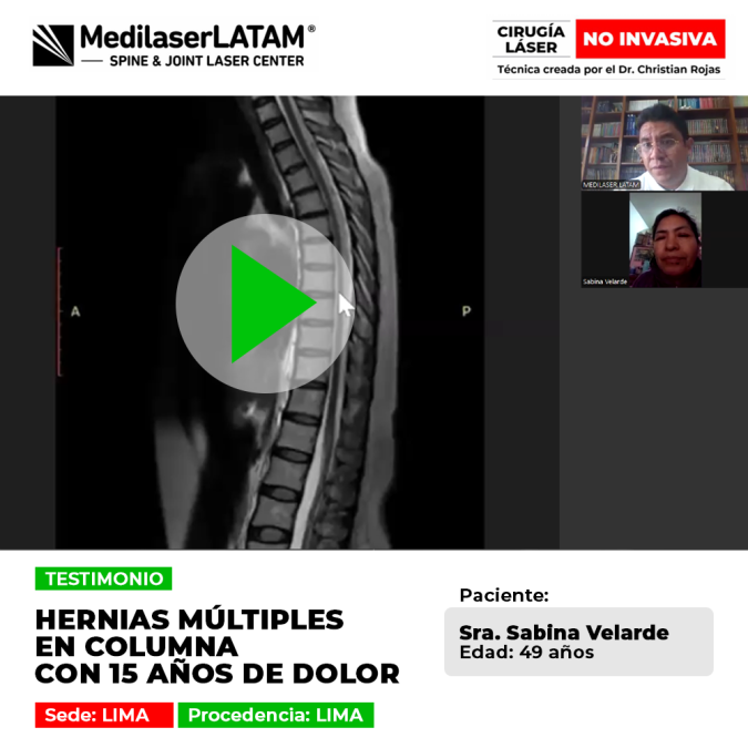 Testimonio de Sabina Velarde (Lima), quien sufrió 15 años de dolor por hernias múltiples en la columna. Vea su recuperación con cirugía láser no invasiva.