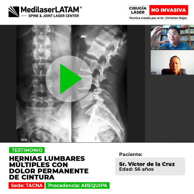 Victor De La Cruz (Arequipa) venció las hernias lumbares y el dolor permanente de cintura. Su testimonio de recuperación en la sede de Tacna.