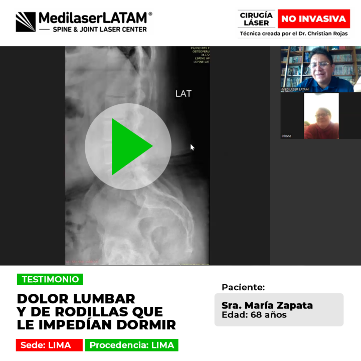 Dolor lumbar rodillas que impedían el descanso a María Zapata. Conozca cómo la cirugía láser de Medilaser LATAM transformó su calidad de vida.
