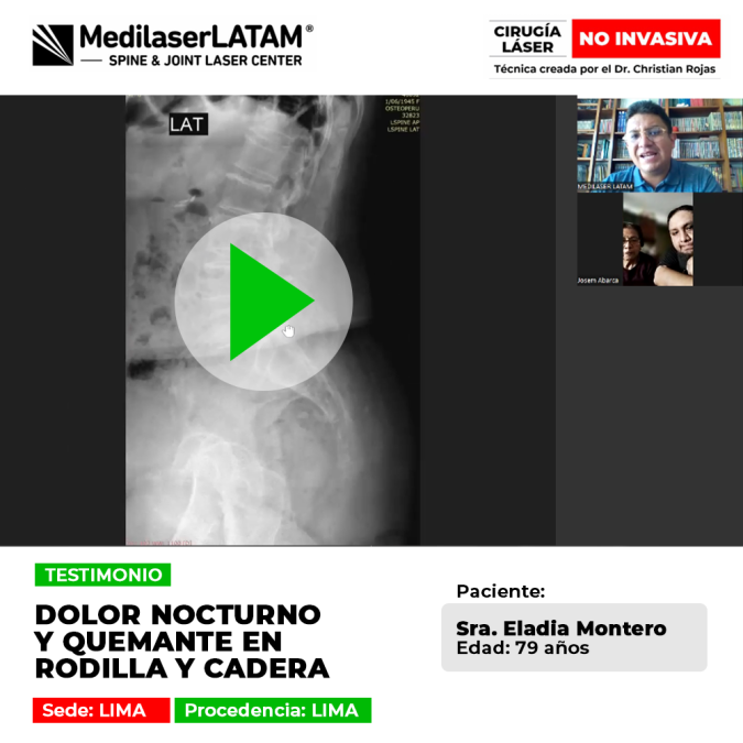 Dolor nocturno rodilla y ardor en la cadera afectaban el sueño de Eladia Montero (79). Conozca cómo la cirugía láser frenó el deterioro articular.