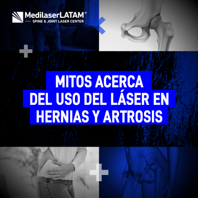 Mitos láser hernias y artrosis: Desmentimos la desinformación más común sobre la cirugía láser no invasiva para articulaciones y columna.