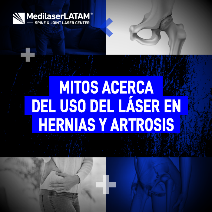 Mitos láser hernias y artrosis: Desmentimos la desinformación más común sobre la cirugía láser no invasiva para articulaciones y columna.