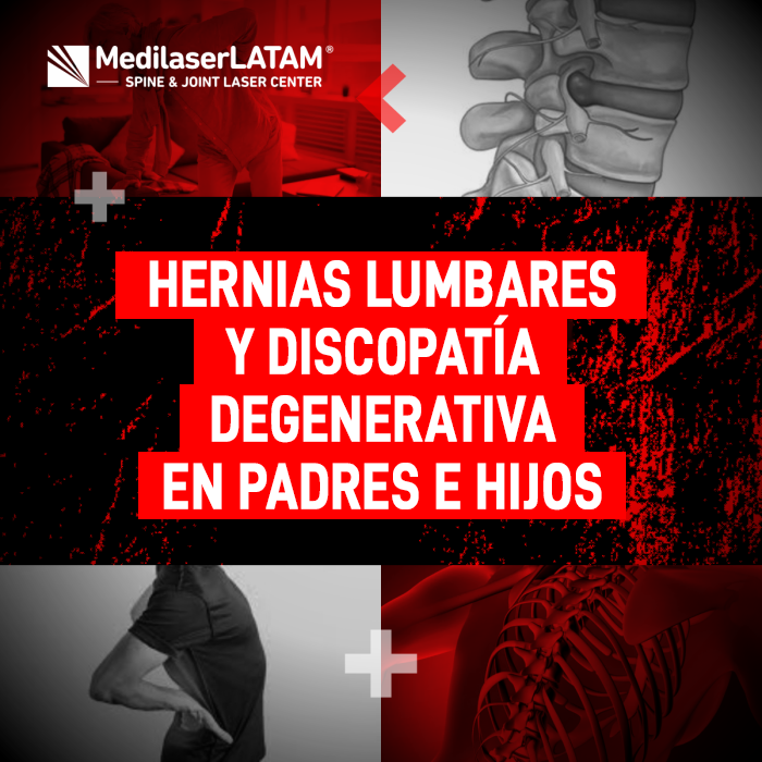 Hernias discopatía familiar: ¿Se heredan? Conoce el componente genético de las hernias lumbares y la discopatía degenerativa.