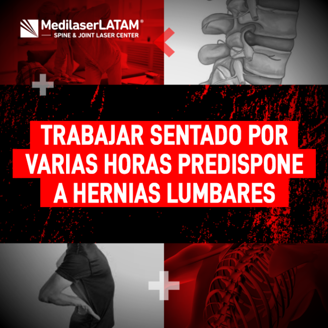 Trabajo sentado hernias: Descubre cómo las malas posturas prolongadas predisponen a hernias y cómo la cirugía láser ayuda a tratar la compresión.