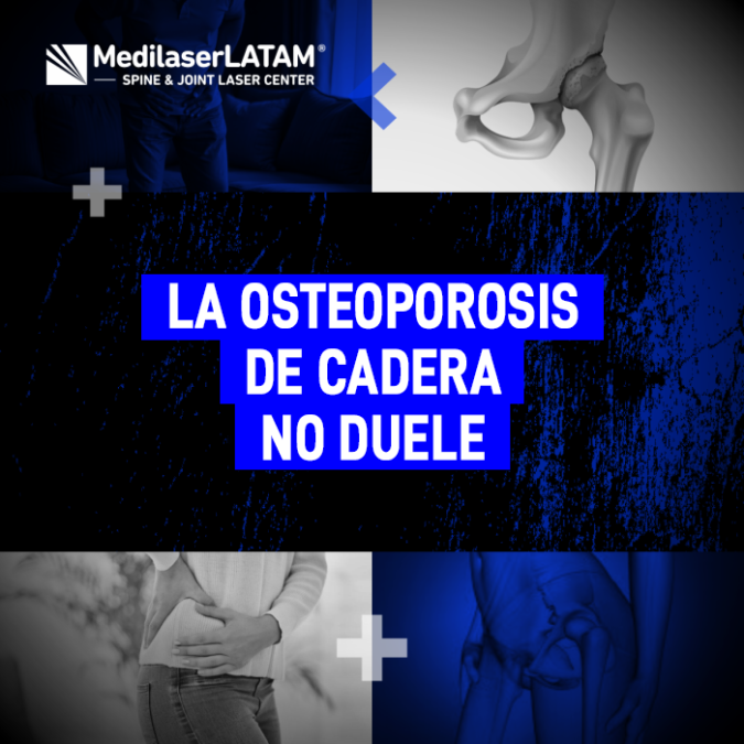 Osteoporosis cadera dolor: Descubre por qué la osteoporosis no causa dolor. El Dr. Rojas explica a profundidad los detalles de la enfermedad