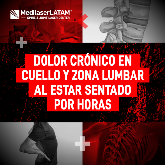 Dolor sentado crónico: El dolor en cuello y zona lumbar al estar sentado indica hernias. El Dr. Rojas explica cómo la cirugía láser alivia la presión.