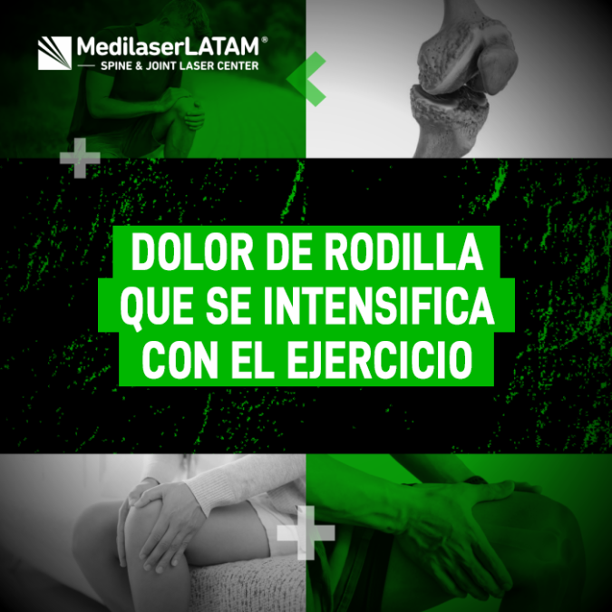 Dolor rodilla ejercicio: ¿Tu dolor se intensifica al hacer ejercicio? El Dr. Rojas explica la señal de alarma que indica daño articular y cómo la cirugía láser actúa.