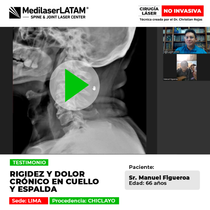 Testimonio: Rigidez Dolor Crónico en cuello y espalda en Manuel Figueroa (66). Vea cómo la cirugía láser no invasiva detuvo el dolor.