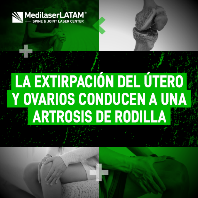 Artrosis de Rodilla: descubre cómo las cirugías de útero y ovarios aceleran el desgaste de cartílago y cómo evitar una prótesis con láser.