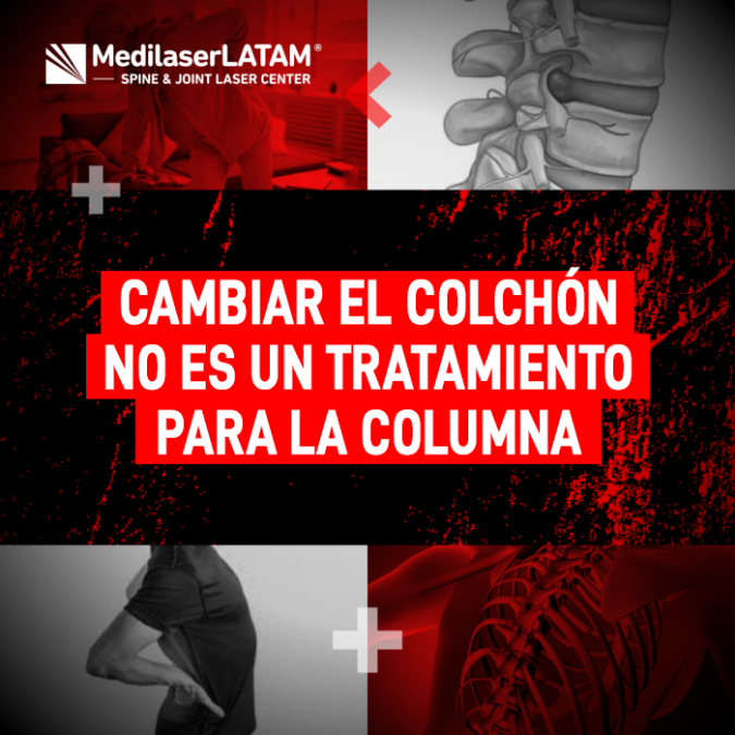 Cambiar el colchón no es un tratamiento para la columna. Descubre por qué el alivio real requiere corregir la raíz del problema con tecnología láser.