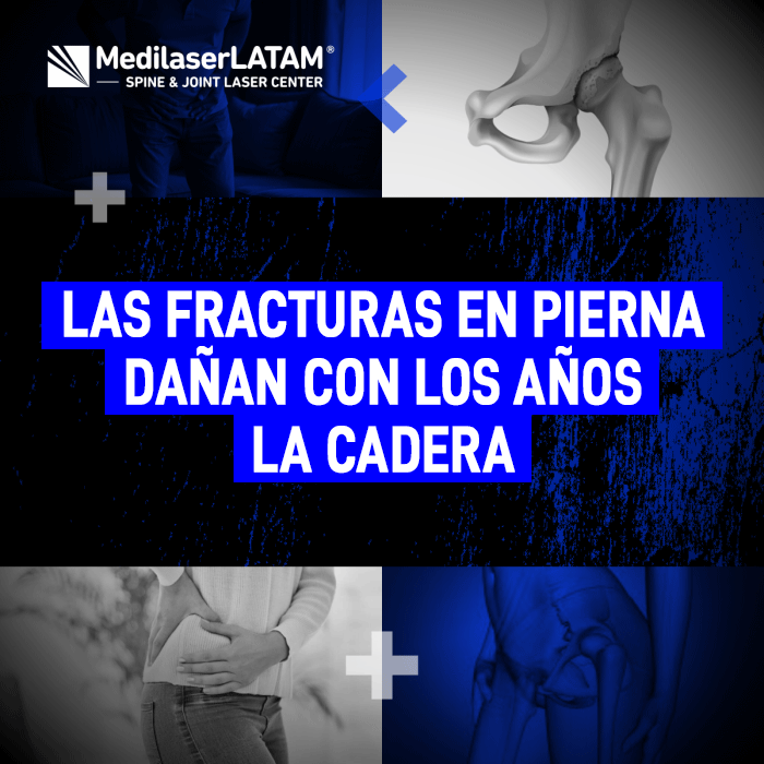 Las fracturas pueden causar artrosis de cadera. El Dr. Rojas explica cómo el daño articular por traumatismos se trata con tecnología láser.