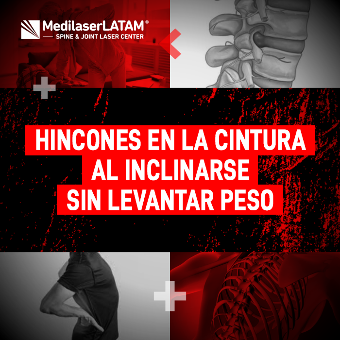 Hincones en la cintura: no ignores estos síntomas al agacharte. Podrían ser hernias lumbares tratables con cirugía láser no invasiva.