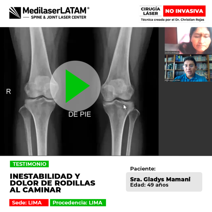Inestabilidad y dolor de rodillas al caminar. Recupera la firmeza y movilidad de tus articulaciones con nuestro tratamiento especializado.