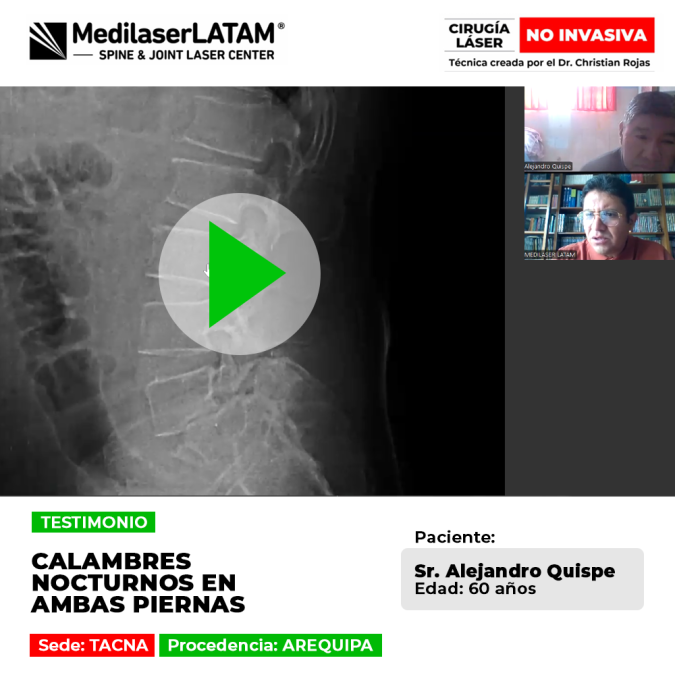Calambres nocturnos en las piernas que impiden el sueño. Solución efectiva para la salud articular y recuperación del descanso profundo.