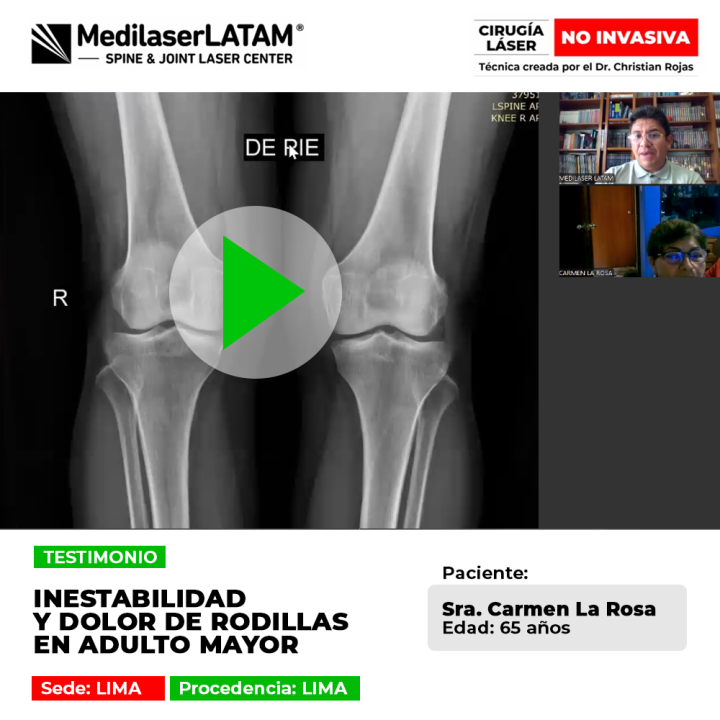 Inestabilidad y dolor de rodillas en adultos mayores: solución efectiva para volver a caminar con seguridad gracias a nuestra tecnología láser.
