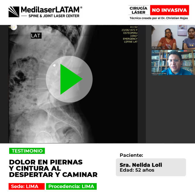 Dolor en piernas y cintura al despertar y caminar. Recupere su movilidad y elimine la rigidez matutina con nuestro tratamiento láser avanzado sin cirugía.