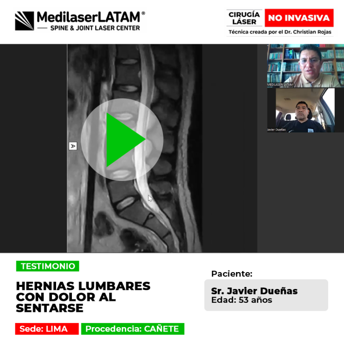 Hernias lumbares con dolor al sentarse. Recupere su vida diaria y elimine el dolor lumbar con nuestro método láser.