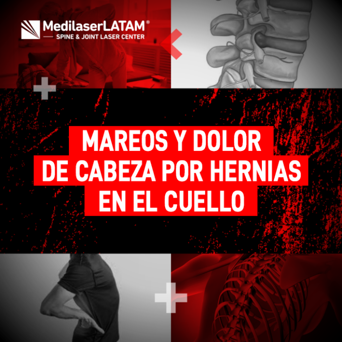Descubre la relación entre los mareos constantes, dolores de cabeza y las hernias en el cuello. Información sobre tratamientos efectivos sin cirugía.