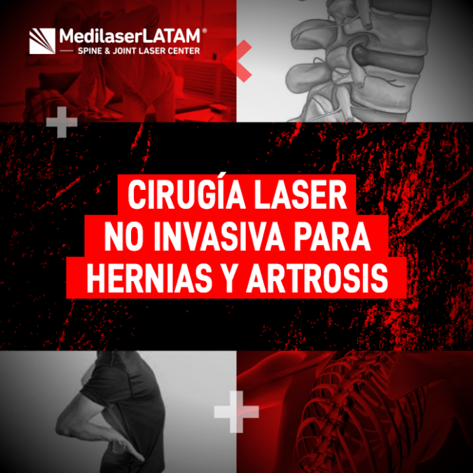 Cirugía láser no invasiva para Hernias y Artrosis. Conozca cómo eliminar el dolor crónico sin los riesgos del quirófano tradicional.