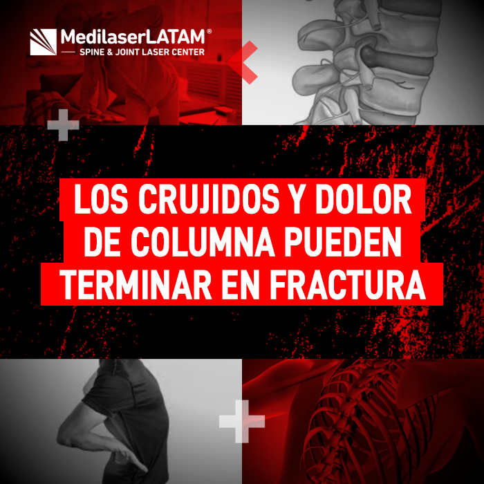 Los crujidos en la columna advierten riesgo de fractura. Elimine el dolor y proteja sus vértebras con tecnología láser de alta precisión.