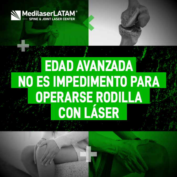 La edad no limita la posibilidad de tratar el desgaste de rodilla. Conoce cómo el procedimiento láser permite una recuperación segura en adultos mayores.