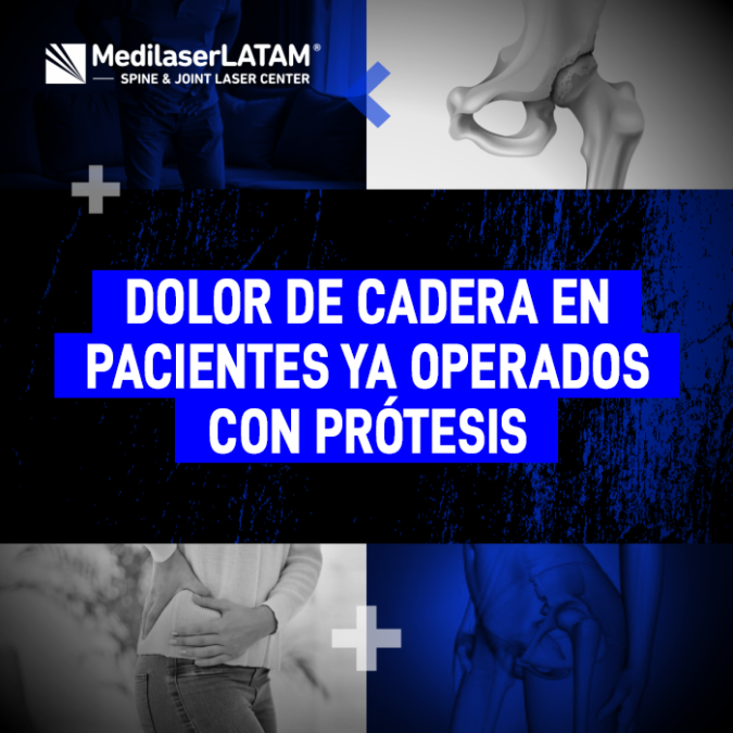 ¿Sufres de Dolor de Cadera tras una operación de Prótesis? Conoce las alternativas de tratamiento láser para aliviar las molestias crónicas.