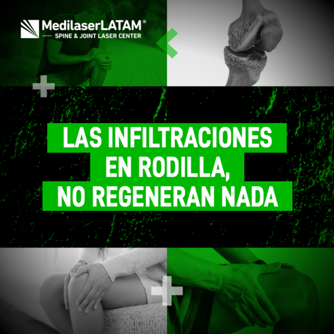 Conoce la realidad sobre las infiltraciones en la rodilla y por qué no solucionan el desgaste. Descubre opciones que sí promueven la recuperación.