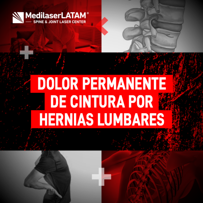 ¿Sufres de dolor permanente de cintura? Conoce cómo las Hernias lumbares afectan tu salud y las opciones de tratamiento láser sin cortes.