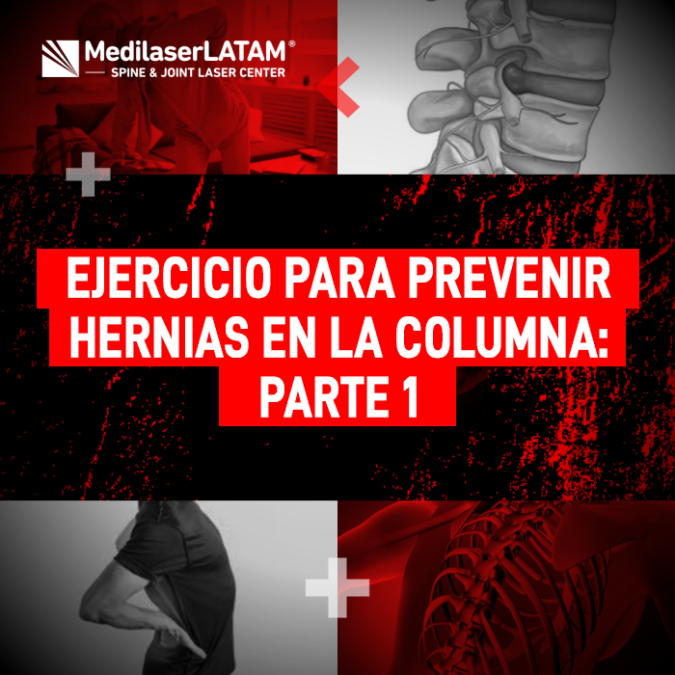 Aprende el mejor ejercicio para fortalecer tu espalda y prevenir Hernias en la columna. Mejora tu salud postural con estos consejos médicos.