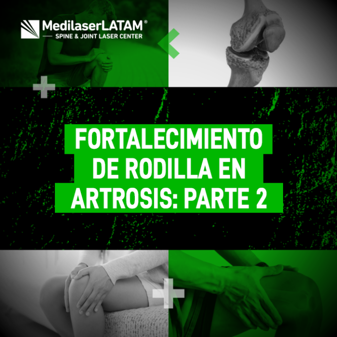 Segunda parte de los ejercicios clave para el fortalecimiento de rodilla en casos de Artrosis. Mejora tu estabilidad y reduce el dolor.