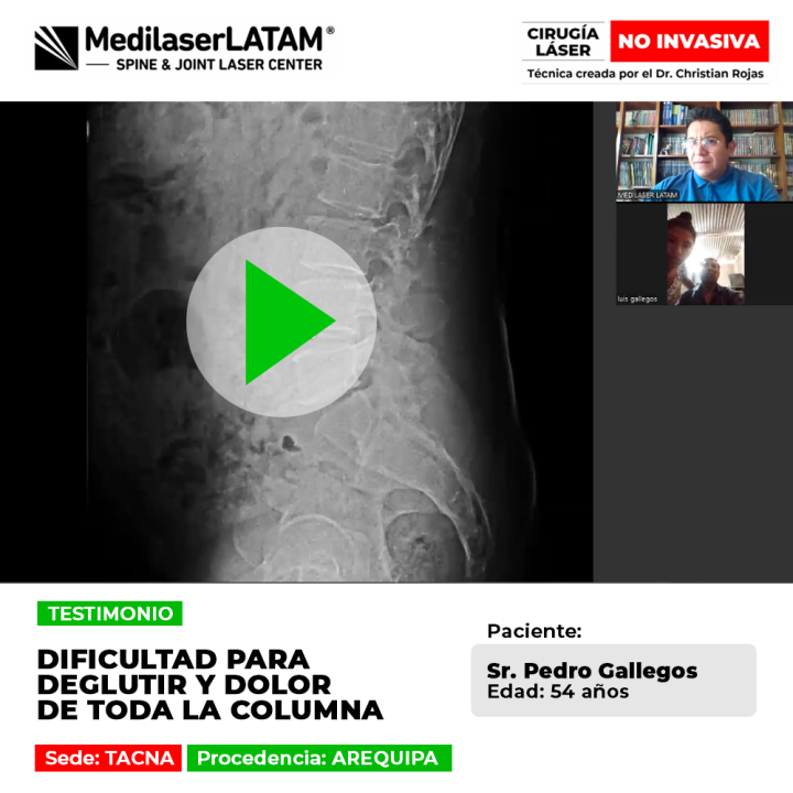 Dolor de toda la columna y dificultad para deglutir: recupere la movilidad y el bienestar con tecnología láser de alta precisión.