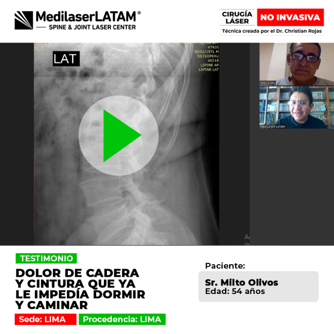 Reporte de recuperación tras sufrir un dolor invalidante de cadera y cintura. Descubre cómo volver a caminar y dormir sin dolor crónico.