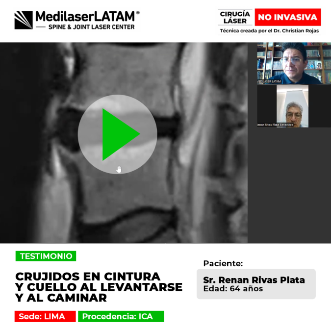 Testimonio sobre cómo eliminar los crujidos constantes en cuello y cintura. Solución efectiva para el desgaste articular severo con láser.