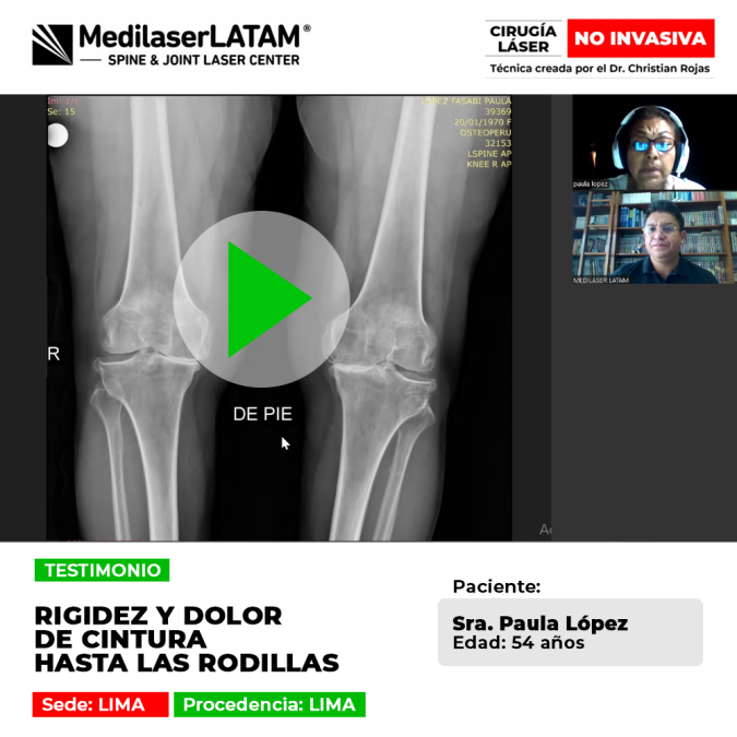 Paciente logra superar la rigidez y el dolor crónico que se extendía desde la cintura hasta las rodillas. Conoce su proceso de recuperación con láser.