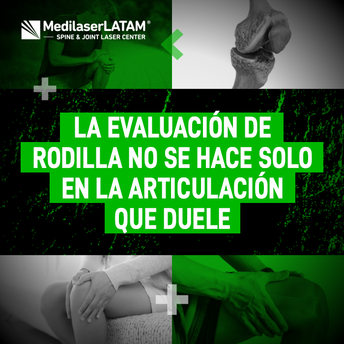 Evaluación de rodilla: descubre por qué el origen del dolor puede estar fuera de la articulación y cómo realizar un diagnóstico preciso.