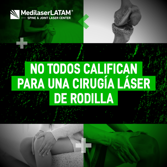 Cirugía láser de rodilla: conoce los criterios médicos indispensables para saber si eres apto para este procedimiento avanzado sin cortes.