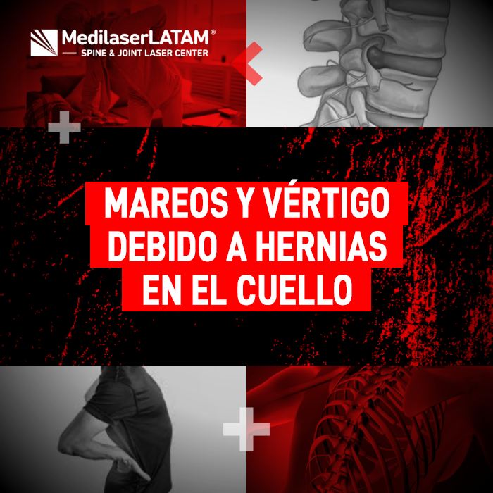 Hernias en el cuello: descubre la relación entre el desgaste cervical y los cuadros de mareos o vértigo que afectan tu equilibrio diario.