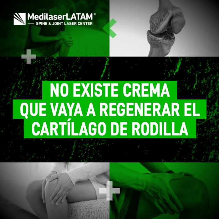 Cartílago de rodilla: la verdad sobre las cremas milagrosas y por qué la tecnología láser es la única capaz de estimular la regeneración.