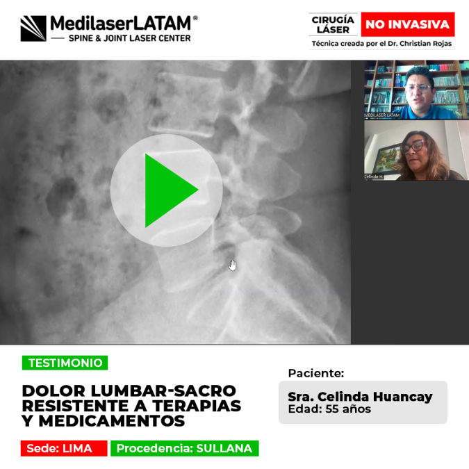 Paciente logra superar un cuadro de dolor lumbar-sacro que no cedía ante fármacos ni terapias convencionales. Conoce su recuperación con tecnología láser.