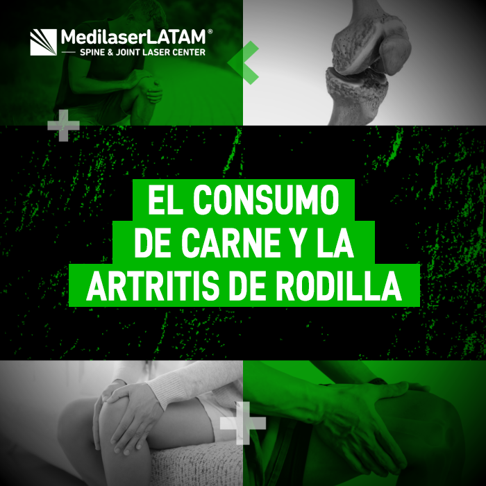 Artritis de rodilla y alimentación: cómo el consumo de carne influye en la inflamación articular y qué medidas tomar para proteger tu salud.