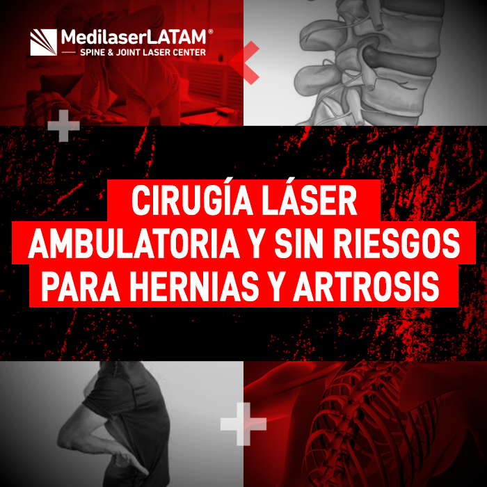 Cirugía láser ambulatoria para tratar hernias y artrosis sin cortes. Infórmate sobre este procedimiento médico seguro en Medilaser LATAM.