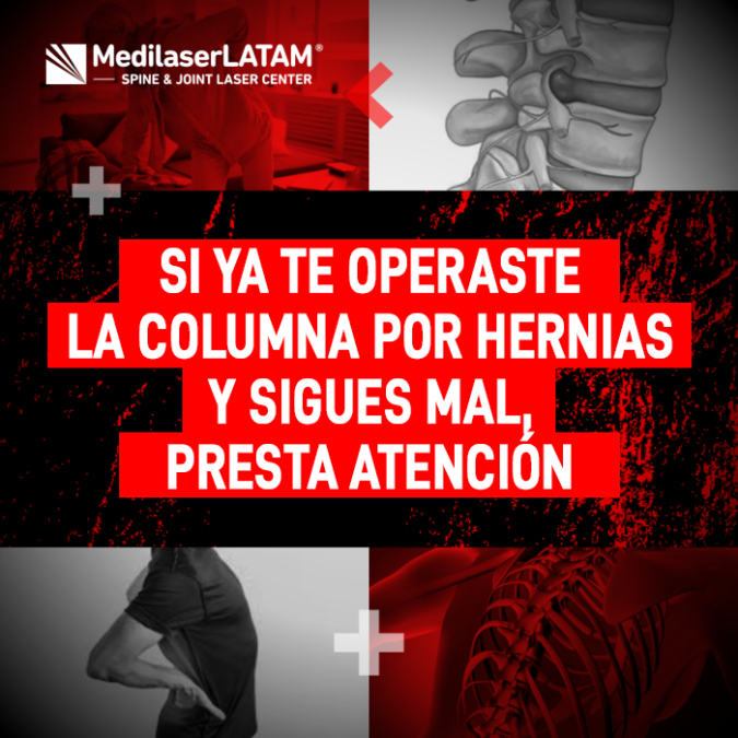 ¿Dolor tras cirugía de columna? El Dr. Rojas explica por qué las molestias persisten y cómo el láser médico es la solución definitiva.