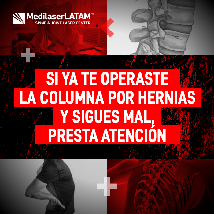 ¿Dolor tras cirugía de columna? El Dr. Rojas explica por qué las molestias persisten y cómo el láser médico es la solución definitiva.