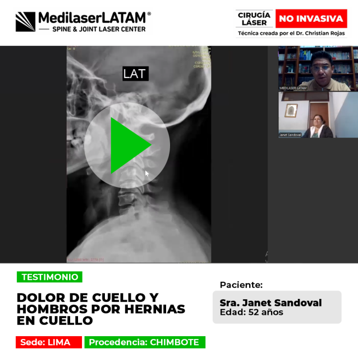 Dolor de cuello y hombros causado por hernias. Conoce este testimonio sobre el tratamiento láser para recuperar tu salud en Medilaser Latam.