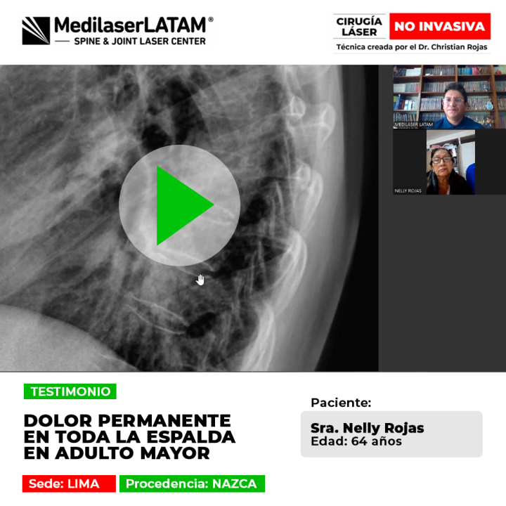 Dolor permanente en la columna vertebral. Aprende por qué nuestra tecnología es la mejor opción para regenerar discos dañados sin riesgos.
