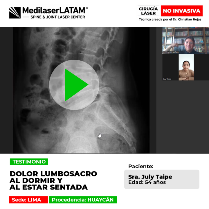 ¿Sufres de dolor lumbosacro al descansar? Mira cómo este tratamiento láser especializado devuelve el bienestar y la movilidad en Medilaser LATAM.