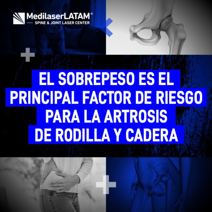 Entiende cómo el exceso de peso acelera el desgaste articular en tren inferior y las medidas tecnológicas para frenar este daño.