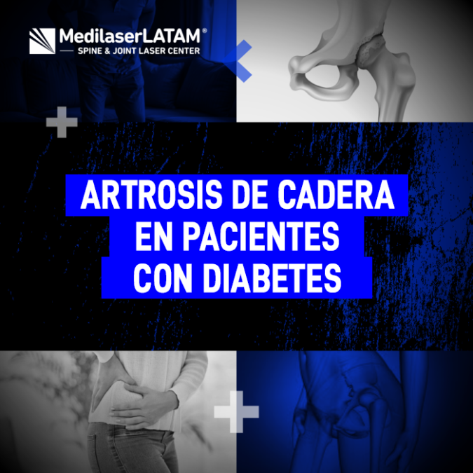 Infórmate sobre la relación entre la diabetes y el desgaste articular, y las opciones médicas para frenar el daño en la cadera.